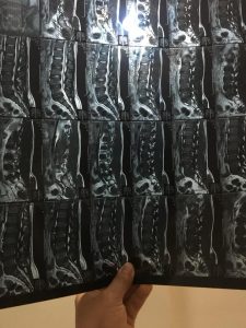 hình chụp MRI