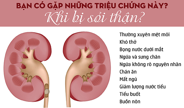 triệu chứng sỏi thận
