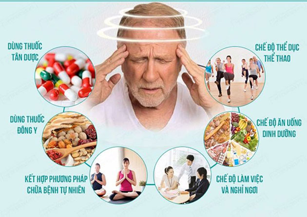 châm cứu chữa rối loạn tiền đình rất hiệu quả