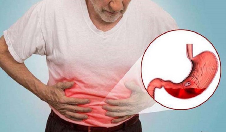 đau dạ dày lan ra 2 mạng sườn