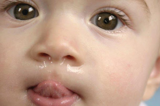 triệu chứng bé bị cảm lạnh, sổ mũi, chảy nước mũi trong