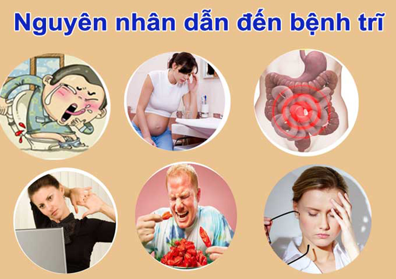 Nguyên nhân gây bệnh trĩ